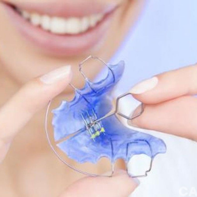Aparatele dentare mobile
