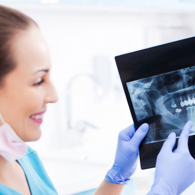 Radiografia panoramică