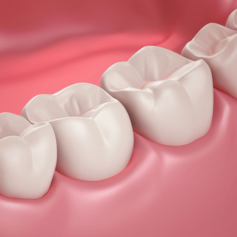 Tratamentul gingiilor