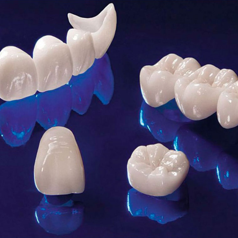 Coroane dentare din zirconiu